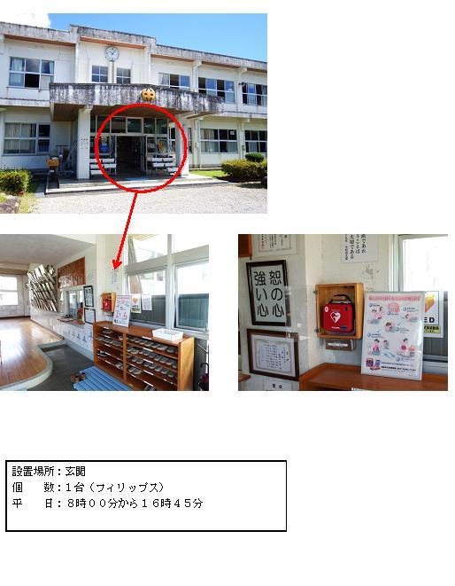 上段：白を基調とした2階建ての校舎で、2階の壁部分に時計、1階の玄関庇側面部分に校章のマークが飾られている飫肥中学校の外観写真。中段左：スリッパが並べて置かれている下駄箱上部の壁に木棚が設置されており、その中に赤色のAEDが収納されている写真。中段右：「恕の心強い心」と書かれた額縁が賞状とともに壁にかけてあり、その横の木棚に赤色のAEDが収納されている写真。下段：「設置場所：玄関 個数：1台（フィリップス）平日：8時00分から16時45分」と書かれた案内文